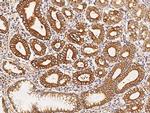 PIST Antibody in Immunohistochemistry (Paraffin) (IHC (P))