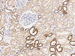 GSTM5 Antibody in Immunohistochemistry (Paraffin) (IHC (P))