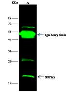 GSTM5 Antibody in Immunoprecipitation (IP)