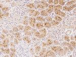 HGF Antibody in Immunohistochemistry (Paraffin) (IHC (P))