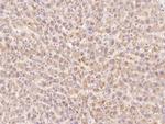 HGF Antibody in Immunohistochemistry (Paraffin) (IHC (P))