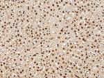 HMGB1 Antibody in Immunohistochemistry (Paraffin) (IHC (P))