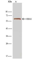 IL12RB1 Antibody in Immunoprecipitation (IP)