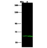 IL12RB1 Antibody in Western Blot (WB)