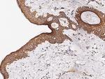 IL1F10 Antibody in Immunohistochemistry (Paraffin) (IHC (P))