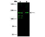 CD103 Antibody in Western Blot (WB)