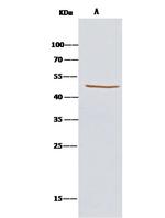 KYNU Antibody in Immunoprecipitation (IP)