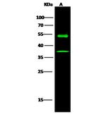 KYNU Antibody in Western Blot (WB)