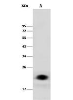 NGAL Antibody in Western Blot (WB)