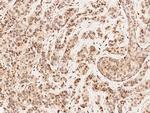 MAP2K4 Antibody in Immunohistochemistry (Paraffin) (IHC (P))