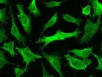 ERK1 Antibody in Immunocytochemistry (ICC/IF)