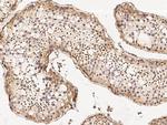 MBD3L1 Antibody in Immunohistochemistry (Paraffin) (IHC (P))