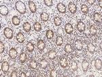 METAP2 Antibody in Immunohistochemistry (Paraffin) (IHC (P))