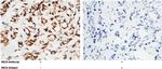 MICA Antibody in Immunohistochemistry (Paraffin) (IHC (P))