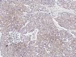 Melan-A Antibody in Immunohistochemistry (Paraffin) (IHC (P))