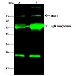 MRE11 Antibody in Immunoprecipitation (IP)