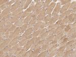 MRPL44 Antibody in Immunohistochemistry (Paraffin) (IHC (P))