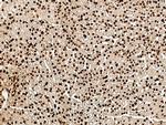 MRTO4 Antibody in Immunohistochemistry (Paraffin) (IHC (P))