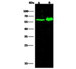 CD204 Antibody in Western Blot (WB)