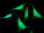 SNAP alpha/beta Antibody in Immunocytochemistry (ICC/IF)