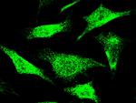 NCAPH Antibody in Immunocytochemistry (ICC/IF)