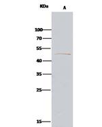 PARVA Antibody in Immunoprecipitation (IP)