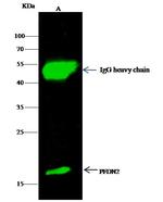 PFDN2 Antibody in Immunoprecipitation (IP)