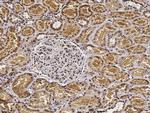 PHYH Antibody in Immunohistochemistry (Paraffin) (IHC (P))