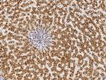 PHYH Antibody in Immunohistochemistry (Paraffin) (IHC (P))