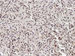 PHYH Antibody in Immunohistochemistry (Paraffin) (IHC (P))