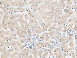 RBP4 Antibody in Immunohistochemistry (Paraffin) (IHC (P))