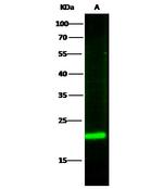 RBP4 Antibody in Western Blot (WB)