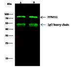 PPM1G Antibody in Immunoprecipitation (IP)