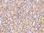 PPP2R1B Antibody in Immunohistochemistry (Paraffin) (IHC (P))