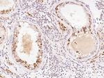 PPP2R1B Antibody in Immunohistochemistry (Paraffin) (IHC (P))