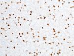 PRDM2 Antibody in Immunohistochemistry (Paraffin) (IHC (P))