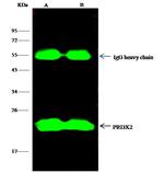 PRDX2 Antibody in Immunoprecipitation (IP)