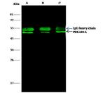 PRKAR1A Antibody in Immunoprecipitation (IP)