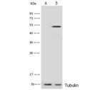 PRKAR1A Antibody in Western Blot (WB)