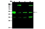 PRKAR1A Antibody in Western Blot (WB)