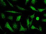 PKC delta Antibody in Immunocytochemistry (ICC/IF)