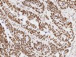 PSME3 Antibody in Immunohistochemistry (Paraffin) (IHC (P))