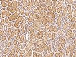 PTPN2 Antibody in Immunohistochemistry (Paraffin) (IHC (P))