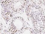 RAD18 Antibody in Immunohistochemistry (Paraffin) (IHC (P))