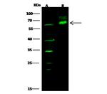 p70 S6 Kinase Antibody in Western Blot (WB)