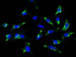 SR-BI Antibody in Immunocytochemistry (ICC/IF)