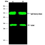 14-3-3 sigma Antibody in Immunoprecipitation (IP)