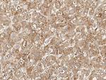 SLC27A5 Antibody in Immunohistochemistry (Paraffin) (IHC (P))