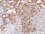 SOCS4 Antibody in Immunohistochemistry (Paraffin) (IHC (P))