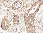 SOD2 Antibody in Immunohistochemistry (Paraffin) (IHC (P))